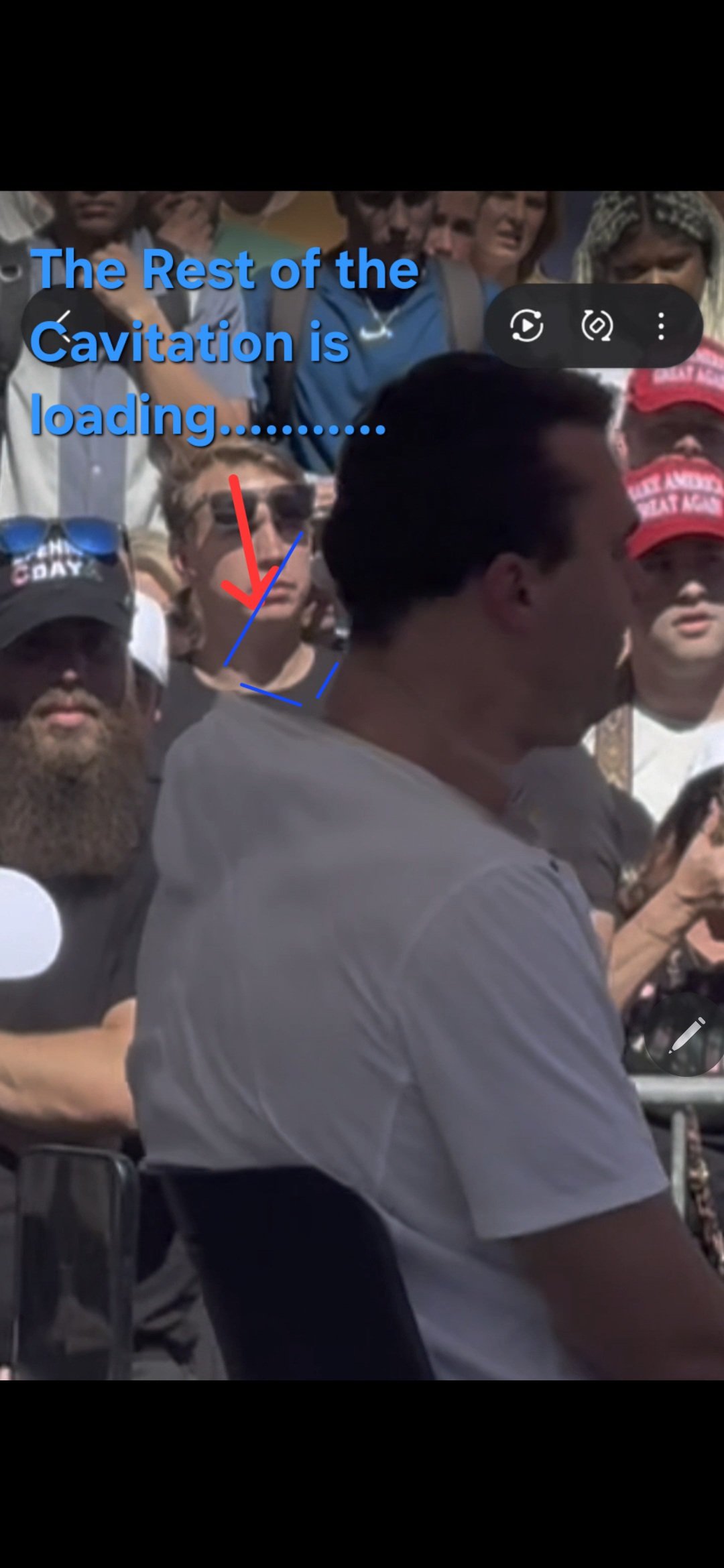 Annotated video frame captioned 'The Rest of the Cavitation is loading.........' with a red arrow and blue outline over the dorsal neck region as Charlie Kirk turns.