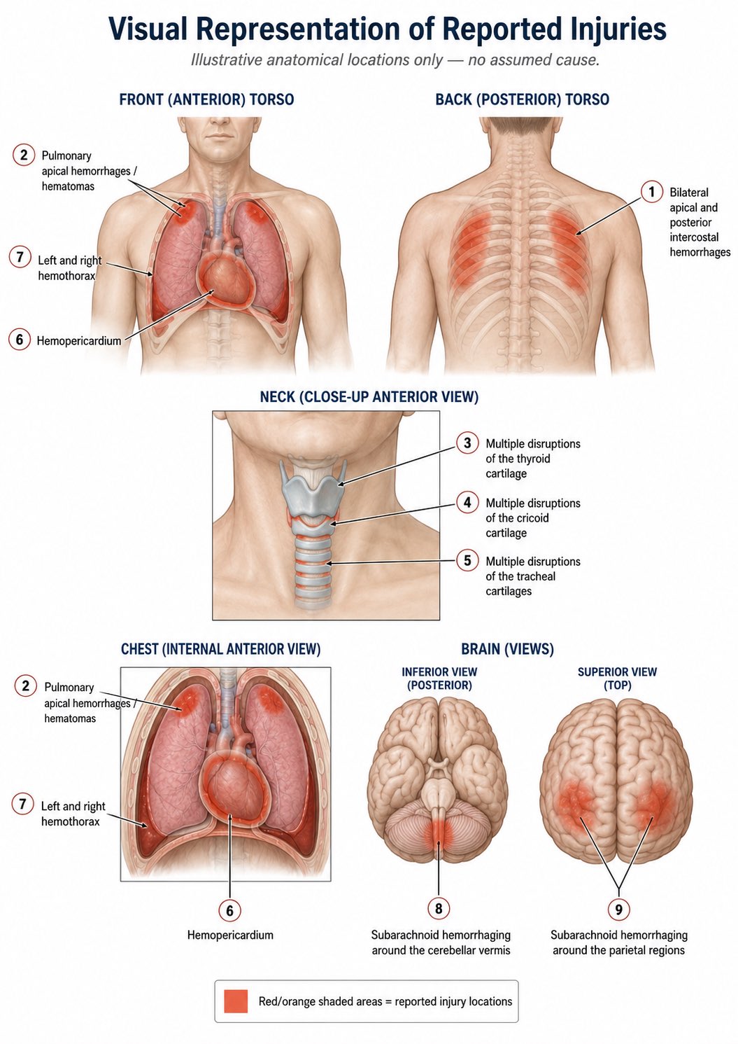 Visual Representation of Reported Injuries — anatomical chart marking, in red, the reported injury locations across the front and back torso, the neck, the internal chest, and two views of the brain.